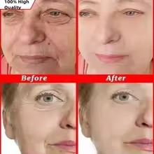 Sérum au Glutathion, à l'Acide Kojique et à la Vitamine C, Essence Éclaircissante pour <span class=keywords><strong>le</strong></span> <span class=keywords><strong>Visage</strong></span>, Sérum Blanchissant au Glutathion pour l'Élimination des Taches Brunes - Product Image 6