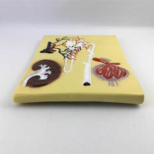 Modelo de Glomerulo de Nefrón Renal Humano de PVC, Sección de Riñón de Plástico, Modelo de Estructura de Corpo de Nefrón Renal, Marca Yulin - Product Image 3