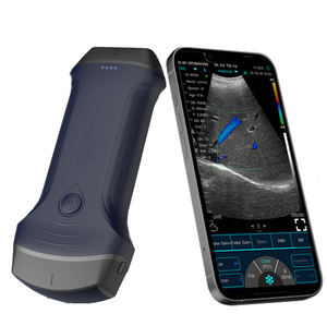 Échographe vétérinaire portable sans fil 3 en 1 à double tête linéaire et convexe avec Doppler couleur - Product Image 2