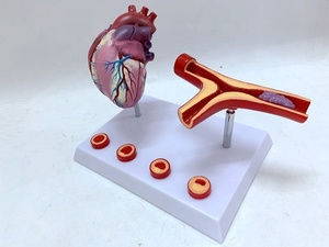 Modelo de injerto de derivación arterial para <span class=keywords><strong>el</strong></span> corazón, modelo de injerto de derivación de la coronaria para la enfermedad cardíaca, se atascan y se forman obstrucciones <span class=keywords><strong>en</strong></span> los vasos - Product Image 2
