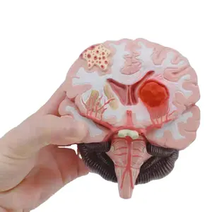 Modelo anatomico de Anatomia, modelo de anatomico PARA LA anatomización de la anatomía del cerebro