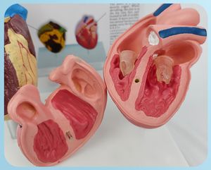 Modello di Anatomia del <span class=keywords><strong>Cuore</strong></span> Umano in 2 Parti, Modelli Didattici in PVC per Confronto tra <span class=keywords><strong>Cuore</strong></span> Sano <span class=keywords><strong>e</strong></span> Malato - Product Image 6