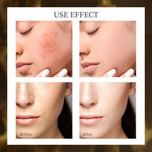 Sérum réparateur en poudre lyophilisé de marque privée Anti-âge dissiper l'acné poudre lyophilisée pour la peau et lysozyme sérum liquide pour le visage - Product Image 6