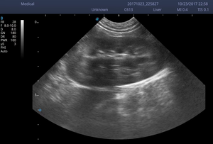 Ecógrafo Doppler Color Portátil Sonoscape E2 <span class=keywords><strong>ProVet</strong></span>, Máquina de Imagenología Digital para Clínica Veterinaria y Hospital - Product Image 5