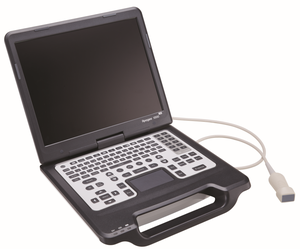 Mejor Precio de Escáner de Ultrasonido Doppler a Color SIUI Apogee 1000 Lite de Alta Calidad con Pantalla de 15 Pulgadas y Larga Vida Útil para Uso Veterinario - Product Image 4