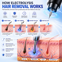 Nouvel appareil d'épilation par électrolyse ZS – Épilateur non invasif à stylo pour tous types de poils