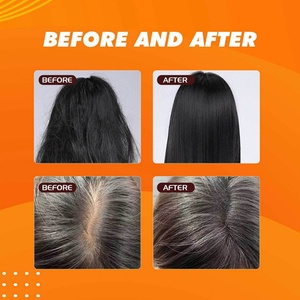 Aceite de Batana 120ml, Aceite Esencial Natural y Orgánico para el Cabello, Nutre y Fortalece las Raíces del Cabello, Para Todo Tipo de Cabello, Fórmula Personalizada - Product Image 6