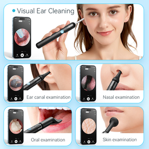 <span class=keywords><strong>Endoscope</strong></span> auriculaire multifonctionnel HD 8MP pour oreilles, bouche, nez et peau, avec kit de retrait de cérumen - Product Image 3