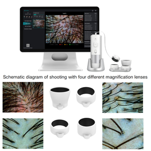 LCD Screen Hair <b>Analysis</b> Scanner System Rechargeable Hair <b>Skin</b> Diagnosis Analyser <b>Machine</b> Professional Beauty Device - Product Image 4