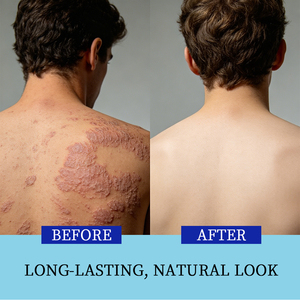 Crema Hidratante Nutritiva de 24 Horas para el Cuidado de la Piel, Calmante para Piel Sensible con Problemas de Psoriasis, Venta al Por Mayor - Product Image 2