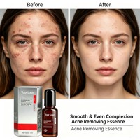 Essence faciale personnalisable de 15 ml, OEM, étiquette privée, sérum nettoyant pour le visage, pour une peau d'apparence saine