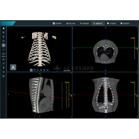 SY-W2920 Equipo Veterinario de Imagenología 3D y Aplicaciones Versátiles, Tomografía Computarizada Veterinaria Específica, Rayos X de Baja Dosis