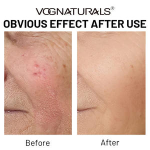 Clean Berry Cream Ménopause Skin Rescue Crème hydratante pour la <span class=keywords><strong>peau</strong></span> pour le soulagement de la sécheresse hormonale - Product Image 4