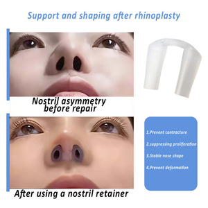 Attelle nasale en silicone pour <span class=keywords><strong>la</strong></span> récupération post-rhino-plastie, dispositif de soutien, modèle [modèle du dispositif], durée de conservation 1 an - Product Image 2