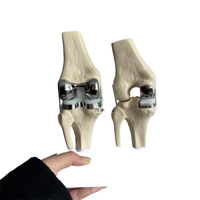 Nouveau modèle 2026 de mannequin détachable pour l'implantation de prothèse de genou double articulée en argent, idéal pour la science médicale et la formation en prothèses de genou.