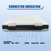 N60 Échographe Portable de Diagnostic Médical Full-Numérique à Écran LCD 15 Pouces avec Doppler Pulsé