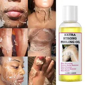 private label african extra strong bleaching oil,dard skin dark knees knuckles removal,skin whitening yellow orange peeling oil