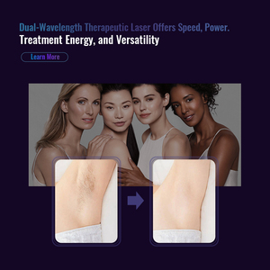 Rejuvenecimiento DE LA PIEL profesional Nd Yag Laser Long Pulse Laser 755nm Alexandrite Nd Yag Long Pulsed Laser Hair Removal Machine - Product Image 6