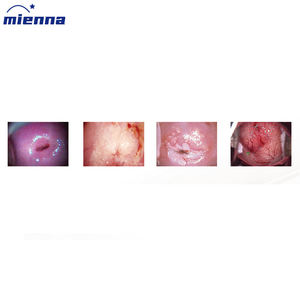 Dispositivos Ginecologia Digital Conjunto Colposcópio Eletrônico Vaginal-eletrônico-colposcópio Equipamentos Médicos Vídeo - Product Image 3