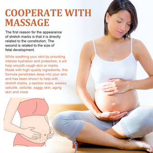 सबसे ज्यादा बिकने वाला शाकाहारी फॉर्मूला स्ट्रेच मार्क मरम्मत लोशन तेजी से काम करने वाली चिकनी त्वचा हल्का अपरेशान शरीर पेट की जांघों की छाती - Product Image 6