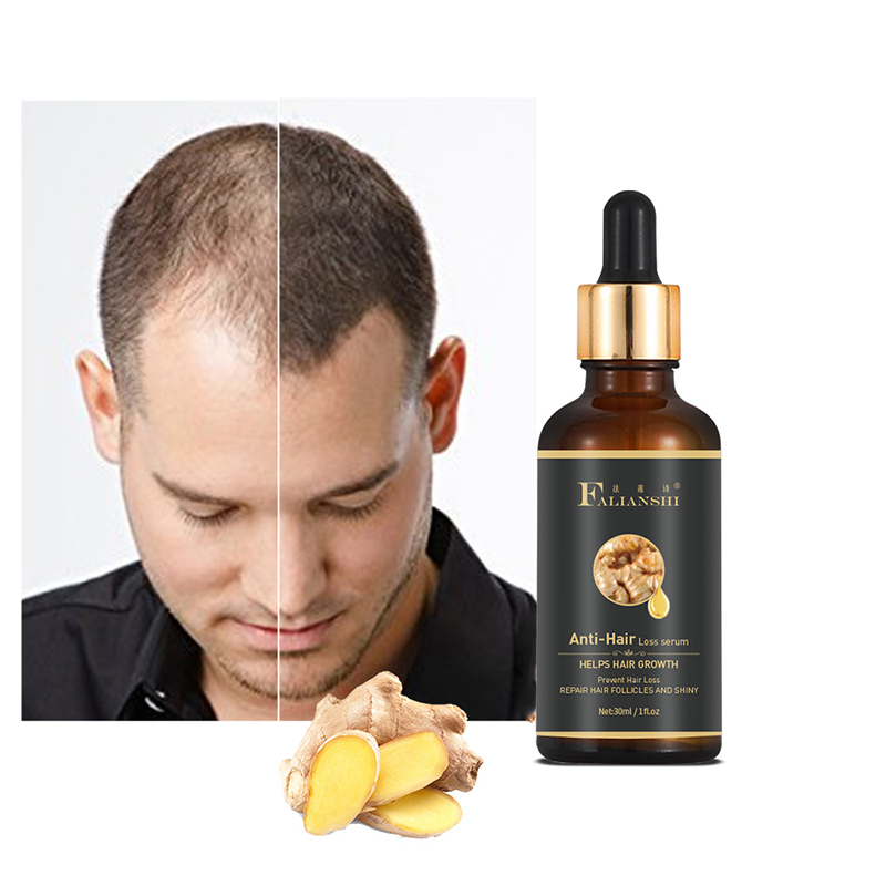 Частная этикетка 30 мл быстрый эффект имбиря Сыворотка для роста волос без побочных эффектов Травяной Растительный Экстракт остановки выпадения волос масло для волос