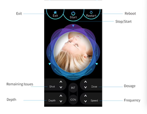 Dispositivo de rejuvenecimiento facial con mesoterapia, mini inyector meso, mesogun, tratamiento facial con agua, rejuvenecimiento de la piel, lifting facial con PRP. - Product Image 4