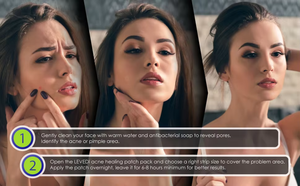 Ensemble de dispositifs d'autocollants pour l'élimination des boutons d'acné et des cicatrices <span class=keywords><strong>Patch</strong></span> kystique hydrocolloïde <span class=keywords><strong>Anti</strong></span>-<span class=keywords><strong>points</strong></span> de marque privée - Product Image 2