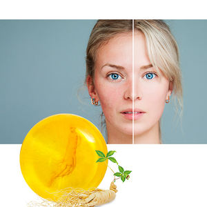 Savon Éclaircissant Fait Main Noir Foncé pour Peau, Savon Blanchissant et Éclaircissant le Visage, <span class=keywords><strong>Traitement</strong></span> Anti-Acné et Hydratant, Soins de Beauté pour la Peau - Product Image 6