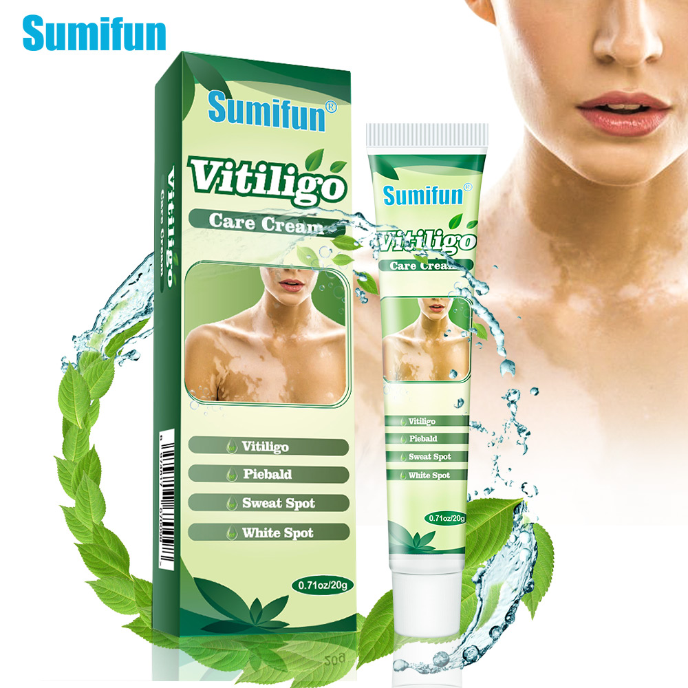 Hot sell White Spot Vitiligo Treatment Cream Herbal Vitiligo Therapeutic Creams Relieve Psoriasis Eczema Vitiligo Ointment