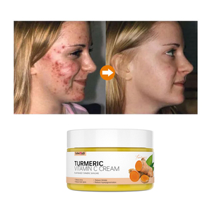 Crema Schiarente Naturale con Logo Personalizzato, Rimozione Macchie Scure, Vitamina C, Sbiancamento Permanente, Crema Organica alla Curcuma per Viso e Pelle Scura - Product Image 2