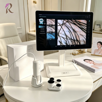 Microscope HD intelligent à faible MOQ pour la détection des follicules capillaires et l'analyse des cheveux avec stockage de données cloud