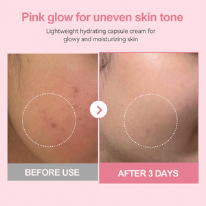 Crème hydratante et nourrissante Santino PDRN au collagène rose en capsules avec acide hyaluronique pour peaux sèches – <span class=keywords><strong>Prix</strong></span> usine - Product Image 3