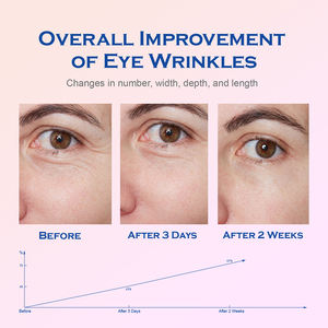 Crema Contorno de Ojos OEM 25ML Antiedad, Anti-Hinchazón, con Ácido Hialurónico y Péptidos, Cuidado para Ojeras, Suero Ligero con Rodillo Aplicador - Product Image 3