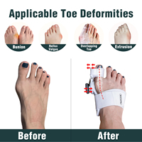 Crème soulageant la douleur des bunions Sumifun, gel correcteur de bunions de tailleur, séparateur d'orteils en gel, attelle pour pieds hallux valgus, soin des pieds 500 OEM/ODM