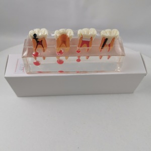 Modelo Dental M4018 para Tratamiento de Pulpa Dental, Herramienta Educativa de Entrenamiento para Uso Doméstico - Product Image 4