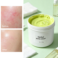 Crème anti-acné à base de plantes en vrac pour fabricants, 1 kg – Crème hydratante professionnelle anti-acné pour salons et marques de soins de la peau