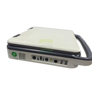 Imagerie diagnostique à ultrasons vétérinaire Écho <span class=keywords><strong>Doppler</strong></span> portable Machine à ultrasons Ecocardiografo entièrement numérique pour animal de compagnie - Product Image 5