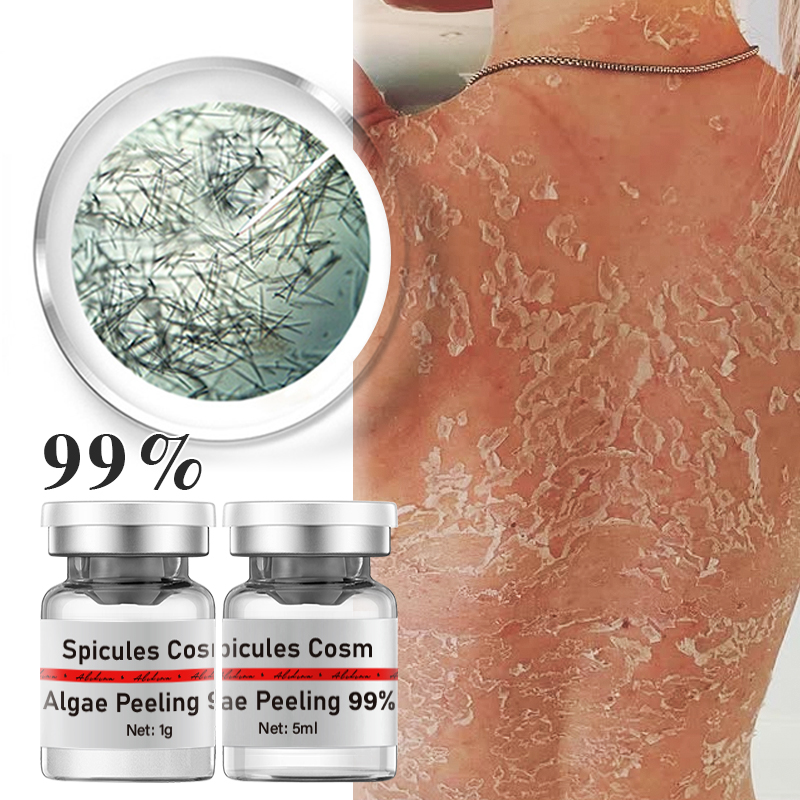 ZS сильный эффект 99% чистый порошок Spongilla Spicules пресноводная гидролизованная губка водоросли пилинг лечение акне кондиционирование кожи