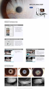 Analizador de Superficie Ocular de Alta Precisión para Diagnóstico de Enfermedades Oftálmicas, Analizador de Ojo Seco para Oftalmólogos - Product Image 4