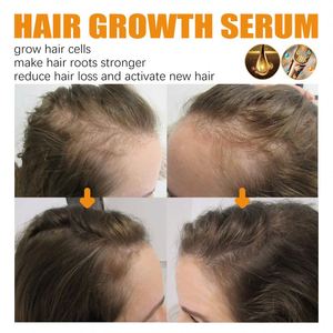 Huile essentielle pour cheveux denses <span class=keywords><strong>West</strong></span> Month, huile essentielle pour réparer les cheveux abîmés, huile essentielle anti-chute - Product Image 3