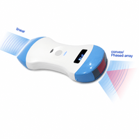 Hochwertiger 3-in-1 Kabelloser Ultraschall-Scanner mit Konvex- und Linearschallkopf, Multimodus-Ultraschallgerät