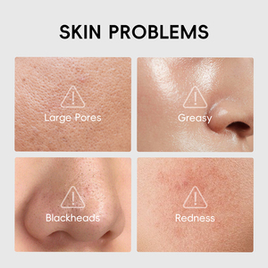 Masque facial exfoliant au charbon de bambou LAIKOU pour éliminer les points noirs, soin de la peau, nettoyage en profondeur, masque facial noir - Product Image 4