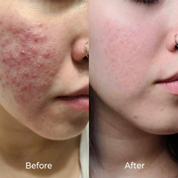 Sérum PDRN 2% REJEON Corée du Sud, best-seller, booster cutané PDRN, sérum rajeunissant, anti-âge, OEM CE/ISO, cliniques esthétiques