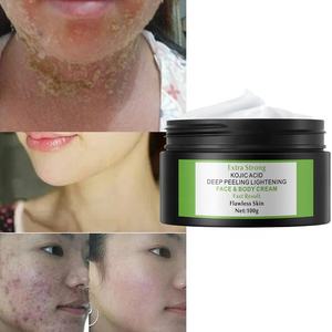 60/100g Acide kojique <span class=keywords><strong>extra</strong></span> fort personnalisé 7 jours Crème éclaircissante pour le visage et le corps Crème blanchissante - Product Image 4