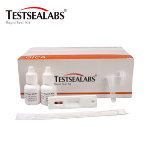 Hot Sale Factory Price High Accurate Respiratory Rapid <strong>Test</strong> Kit <strong>Strep</strong> <strong>a</strong> Antigen <strong>Test</strong> Manufacturer Device <strong>Strep</strong> <strong>a</strong> Ag - Product Image 5