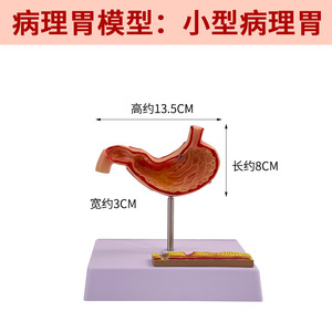 Modelo gástrico patológico en miniatura; modelo gástrico patológico perforado del estómago humano; gastroenterología; coronal - Product Image 1
