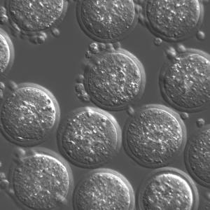 Microscopio de Contraste con Modulación Hoffman MF53-PMC para aplicaciones de asistencia reproductiva IVF - Product Image 3