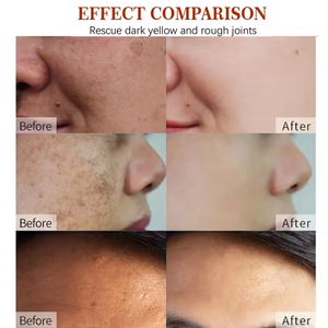 Collagène Niacinamide Anti-Rides Crème Pour Le Visage Vitamine C Acide Hyaluronique Hydratant Blanchissant pour L'élimination Des Taches Noires Soins Du Cou - Product Image 4