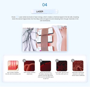 <span class=keywords><strong>Appareil</strong></span> de <span class=keywords><strong>cavitation</strong></span> professionnel Taibo Beauty avec laser diode à vide pour le remodelage corporel et le traitement de la <span class=keywords><strong>cellulite</strong></span> - Product Image 6