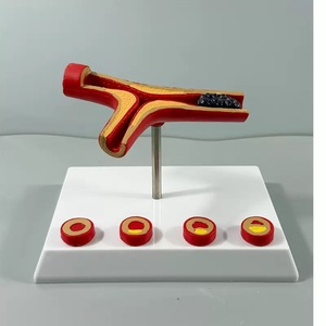 Modelo de Aterosclerosis y Trombosis Humana KyrenMed, Modelo Cardiovascular de Aterosclerosis Ampliado 10 Veces - Product Image 6